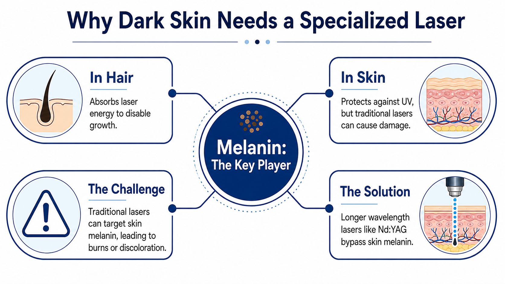 An infographic explaining why specialized lasers are required for safe laser hair removal on dark skin.