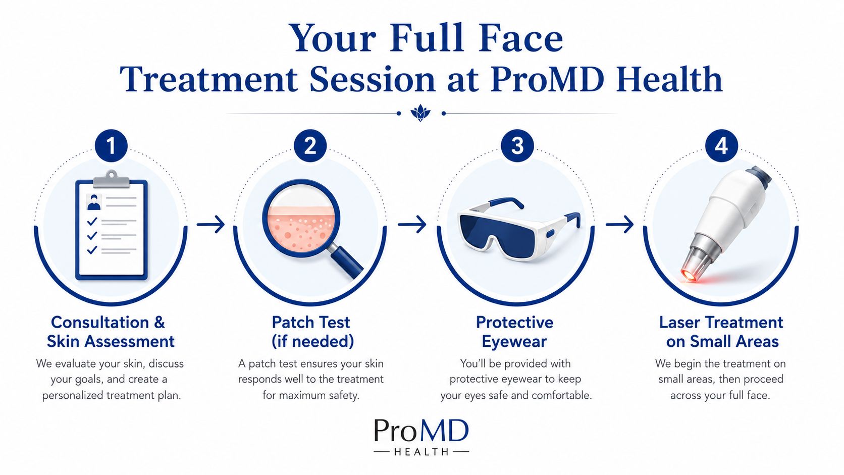 A four-step infographic illustrating the professional full face laser treatment process at ProMD Health clinic.